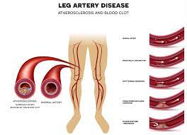 VENOUS ARTERIAL